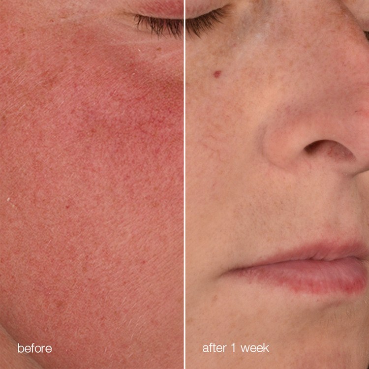 Dermalogica Stabilizing Repair Cream 50 ML + ilmainen matkakoko 2 dermalogica stabilizing repair cream